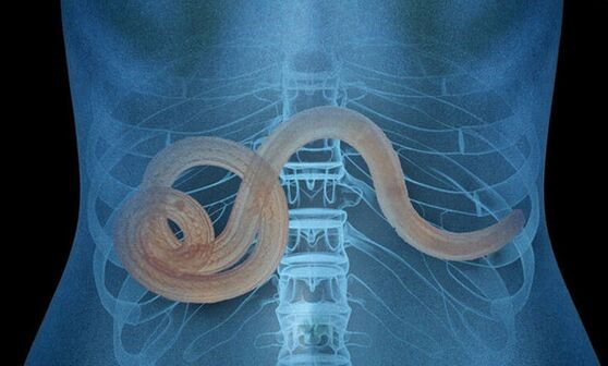 parasites dans le corps humain